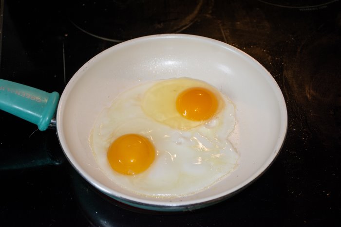 The Keto Diet